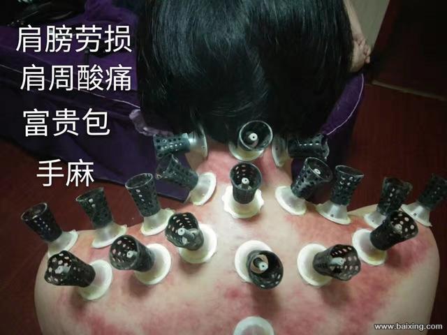 天天艾跟其他艾灸产品的优势如何？